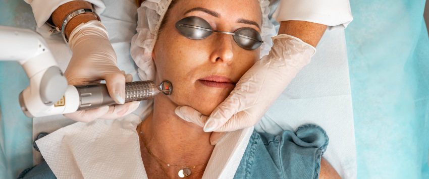 The Benefits Of Laser Treatments For Skin